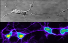 Transport transmembranaire et stockage du zinc dans les neurones. Rôles des canaux cationiques TRPC6